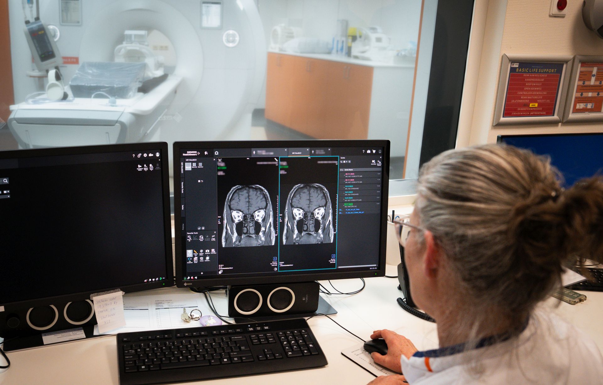 Nieuwe MRI maakt scans in UMCG scherper en sneller